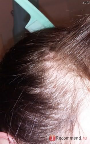 Спрей для волос Alerana для наружного применения 2% фото