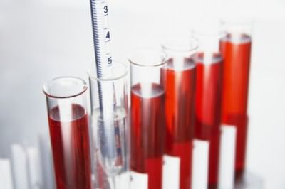 Состав и качество крови дают самую полную информацию о состоянии организма