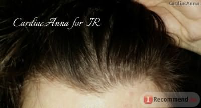 Шампунь-активатор Estel Otium Unique стимулирующий рост волос фото