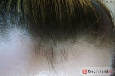 Средство для стимуляции роста волос Hobe Labs Energizer, Hair Follicle Stimulator, 8 fl oz (237 ml) фото