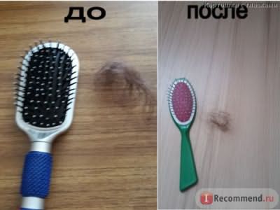 Средство от выпадения волос Vichy AMINEXIL SP94 для Женщин фото